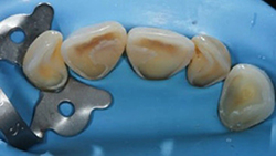 Rondoflex-Plus_fig4_fr.jpg