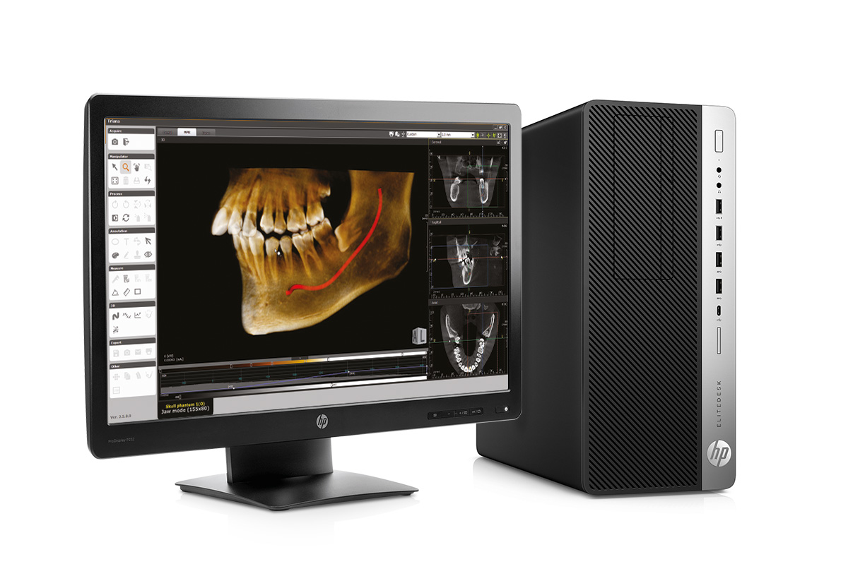 HP Computer station - компьютерная станция для дентального 3D томографа.jpg
