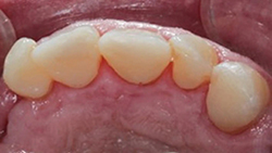 Rondoflex-Plus_fig5_fr.jpg
