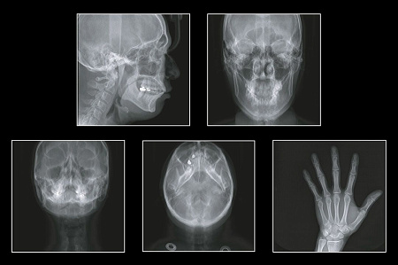 GENORAY Papaya 3D 23x14 - компьютерный томограф 