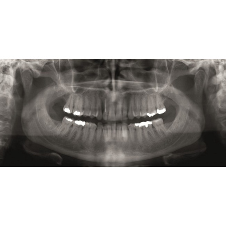 KaVo GENDEX GXDP-300 - цифровая панорамная рентгенодиагностическая система