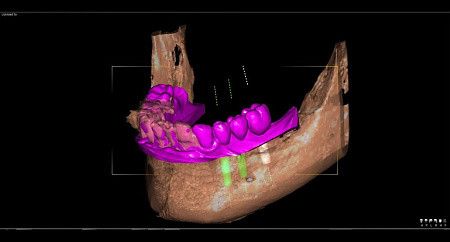 Owandy I-Max Touch 3D Ceph – Конусно-лучевой томограф 9х8