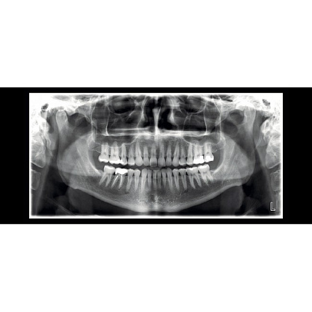 Planmeca ProMax 2D SCARA 2 - рентгеновская установка без цефалостата