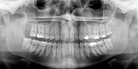 Owandy I-Max Touch 3D Ceph – Конусно-лучевой томограф 9х8