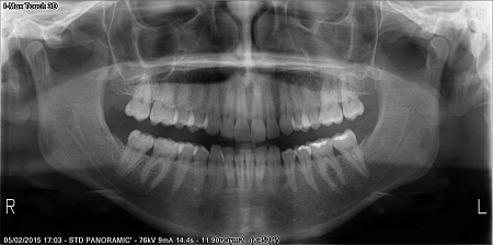 Owandy I-Max Touch 3D – Конусно-лучевой томограф 9х8