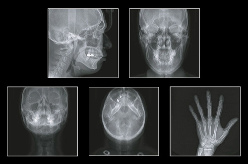 GENORAY Papaya 3D 23x24 - компьютерный томограф 